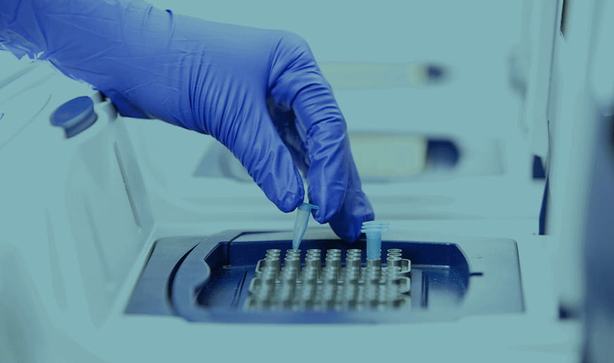 PCR自動化